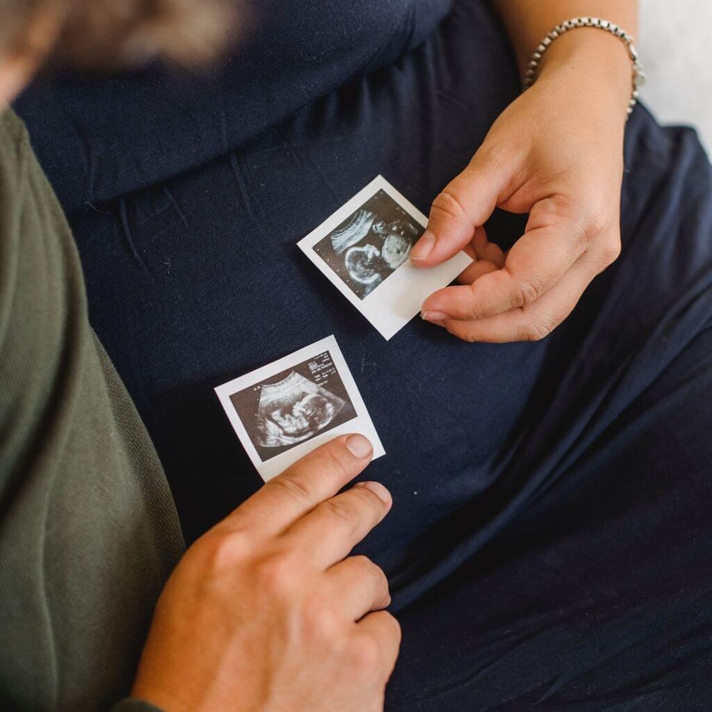 Man and pregant woman holding up sonogram
